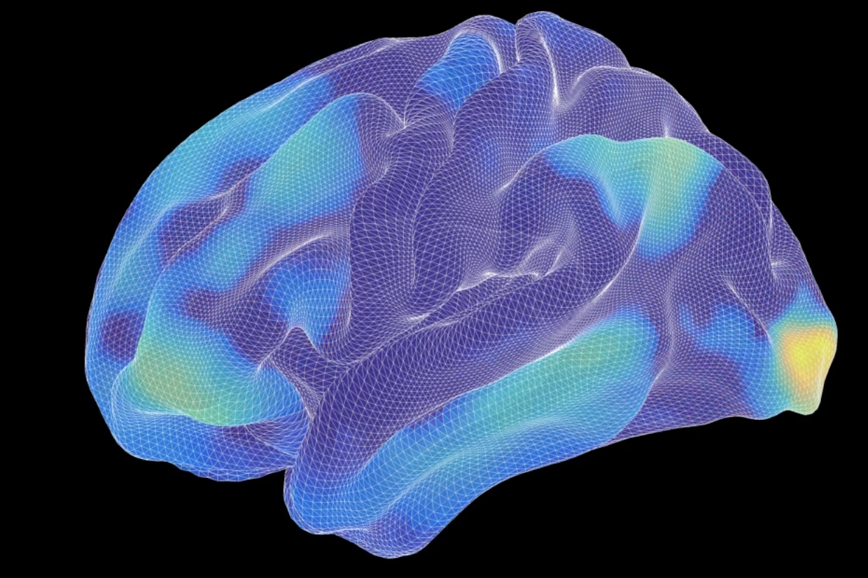 Wireframe brain illuminated in light